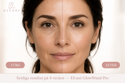 Elvani GlowWand Pro – RF & EMS Ansiktslyftare