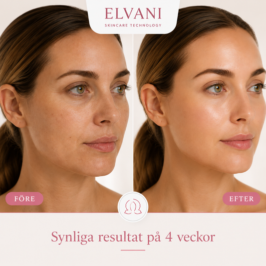Elvani GlowWand Pro – RF & EMS Ansiktslyftare