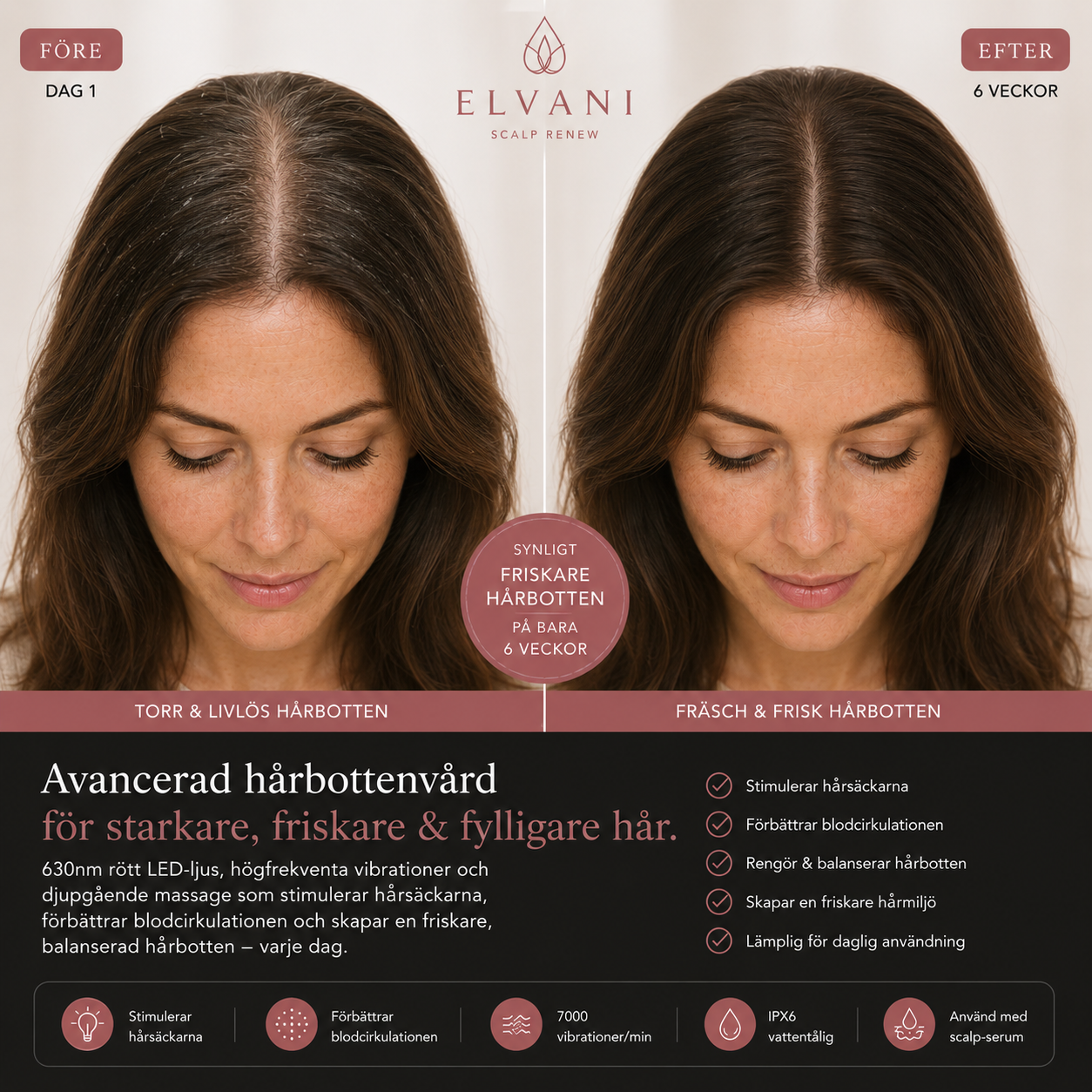 Elvani Scalp Renew