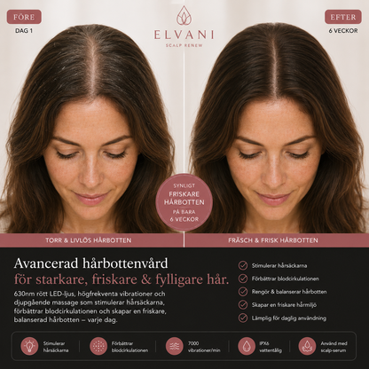 Elvani Scalp Renew
